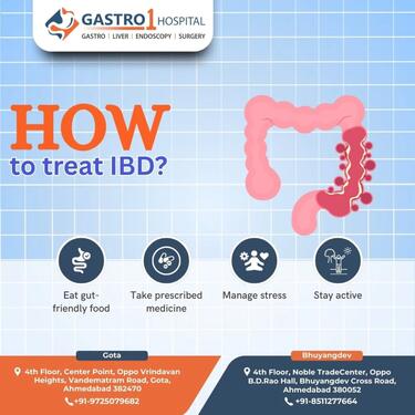 Best IBS Treatment in Ahmedabad
